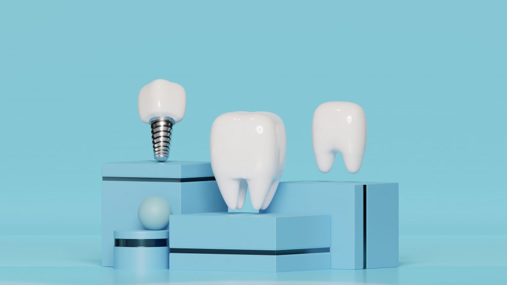 cómo se hace un implante dental